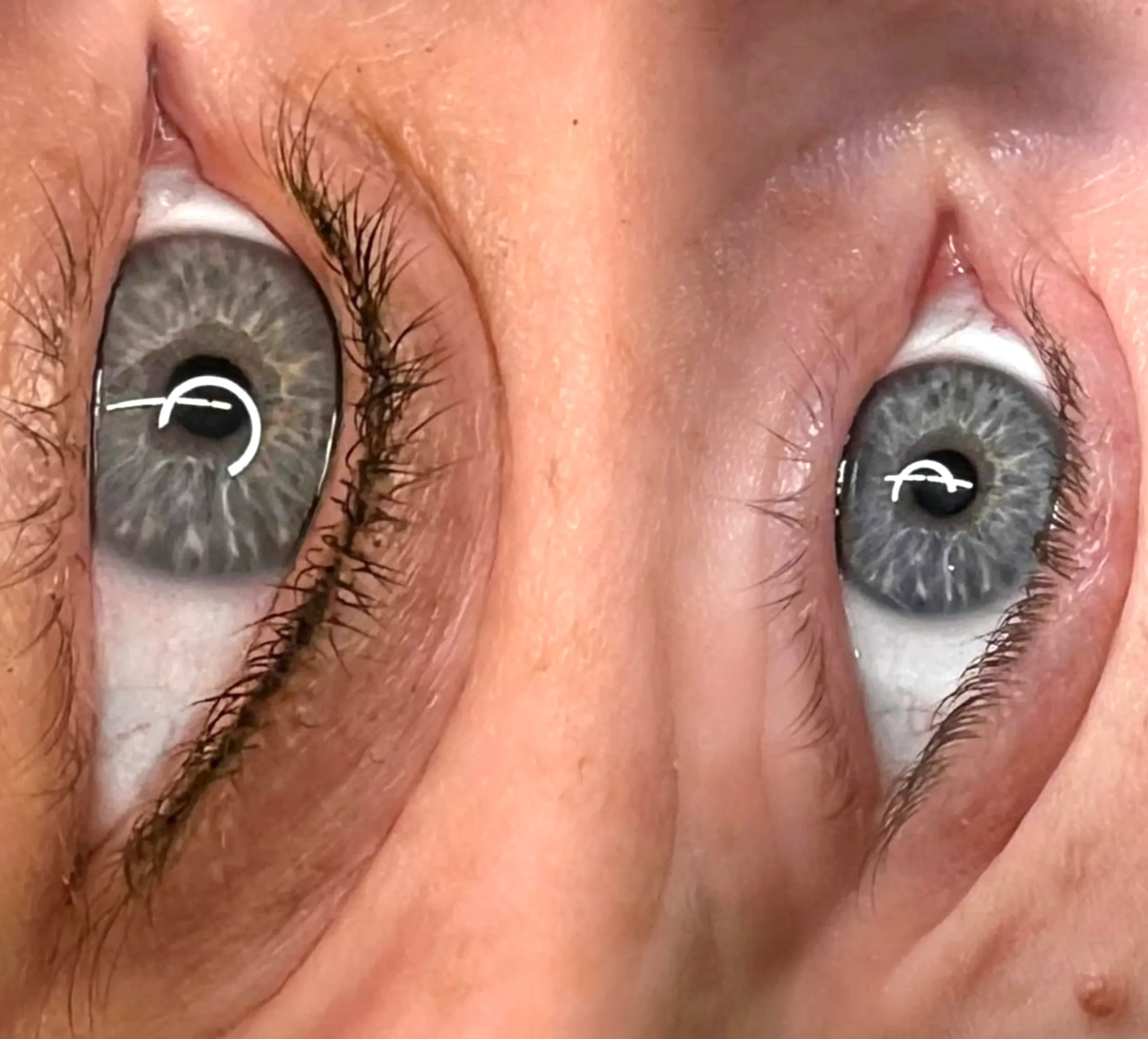 blood thinners eyeliner tattoo